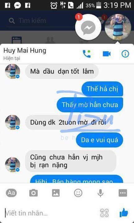 Phản hồi khách hàng sử dụng trị rạn pizu