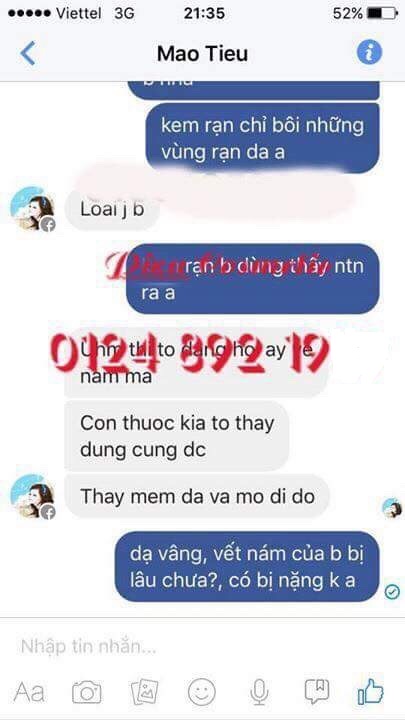 Phản hồi khách hàng sử dụng trị rạn pizu