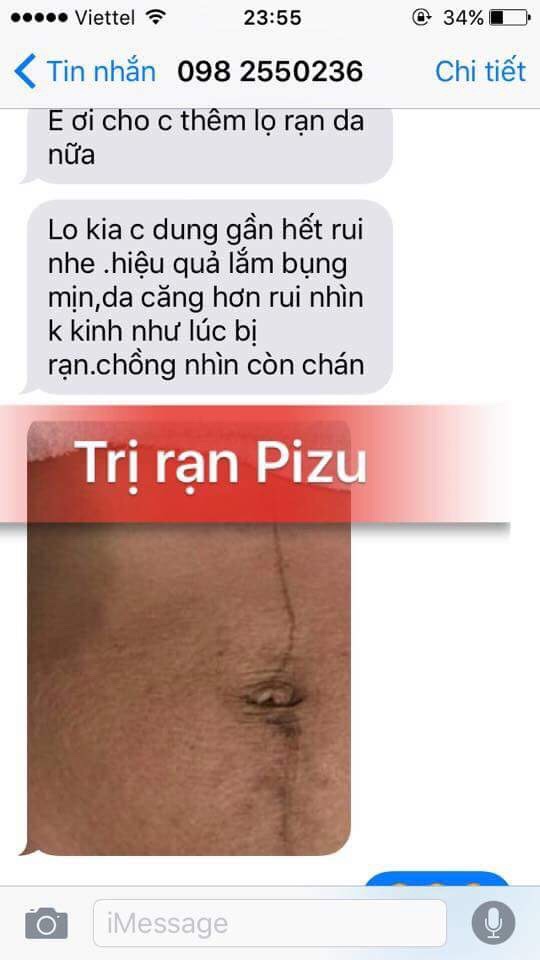 Phản hồi khách hàng sử dụng trị rạn pizu